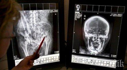 нова техника възстановяване запушени артерии работи света анна