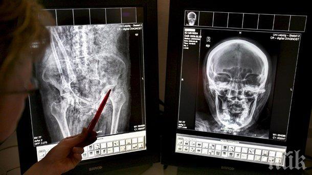 Нова техника за възстановяване на запушени артерии работи в Света Анна