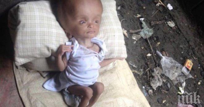 Жена намира това изоставено бебе върху купчина боклук! 2 години по-късно, бебето е неразпознаваемо!


