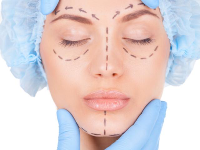 Пластичните операции на звездите, за които не подозирате