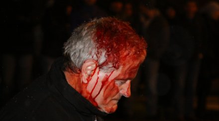 ранен протестиращ полицията инсценира терора орлов мoст снимки