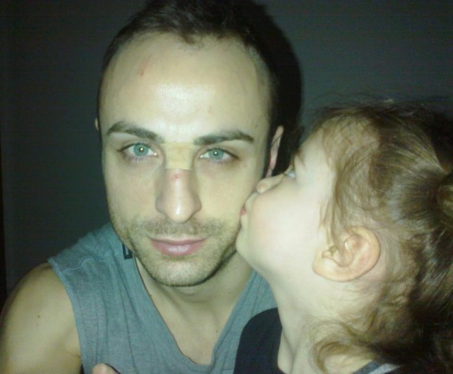 Димитър Бербатов излиза маскиран срещу Стоук Сити