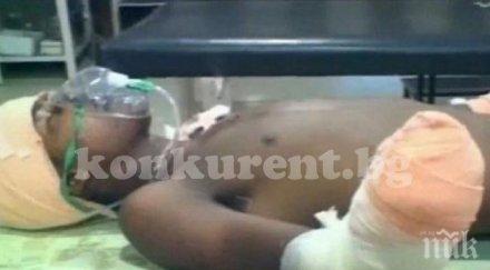 баща отсече ръцете изнасилвача месечната дъщеря