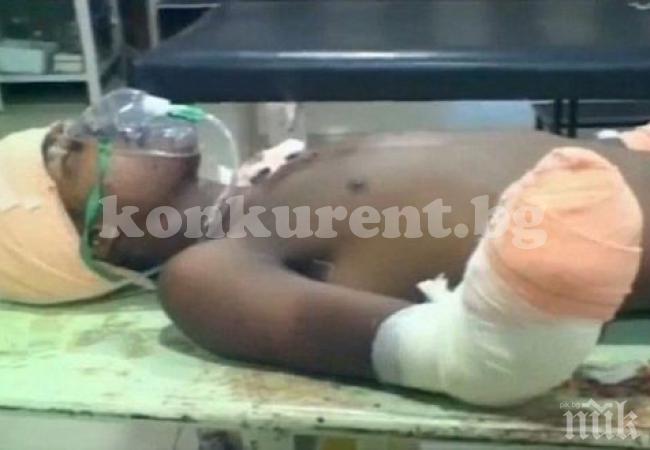 Баща отсече ръцете на изнасилвача на 7-месечната си дъщеря