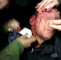 Кървава саморазправа: Перничани се млатиха до кръв на спирка посред бял ден