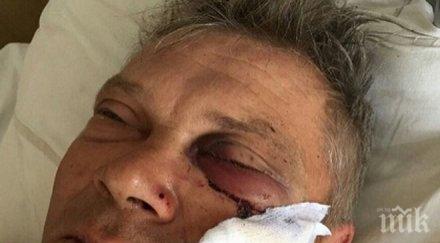 побеснели роми каруци утрепаха рускак сина заради спорна ливада