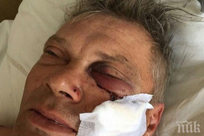 30 побеснели роми с каруци  утрепаха рускак и сина му заради спорна ливада 