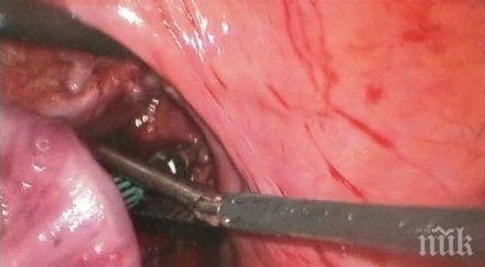 причинява рак стомаха вижте каква опасност дебне снимка