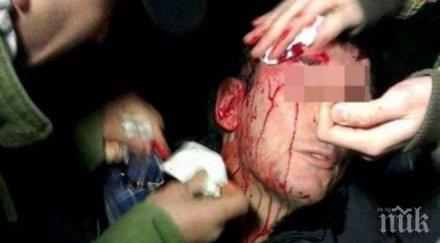 кърваво меле мъж бере душа четирима болница бой роднини