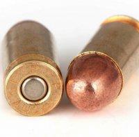 Феномен! Мъж живее 6 години с куршум в главата
