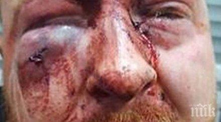 брутално охранители нощен клуб обезобразиха клиент зверски побой снимка