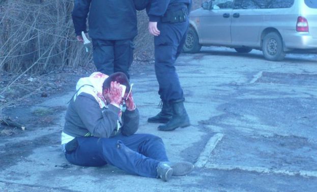 Бой, строшени глави и много кръв преди Лион - Тотнъм