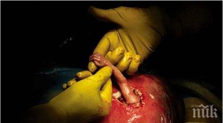 изглежда детето знаменитата снимка ръката надеждата снимки