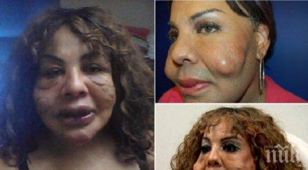 шок водят пластичните операции