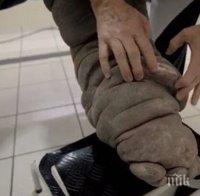 ШОКИРАЩА ДРАМА! След ухапване от комар: Мъж бавно се превръща в слон