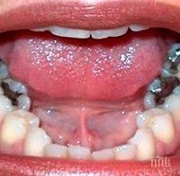 Имайте едно на ум! Болните зъби докарват рак