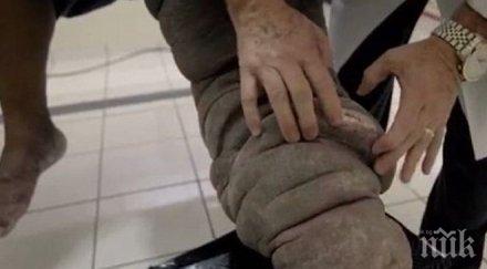 шокираща драма ухапване комар мъж превръща слон