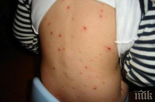 Бум на шарка в Старозагорско  