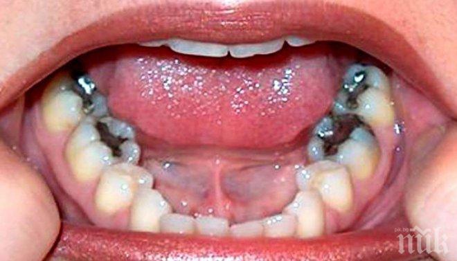 Имайте едно на ум! Болните зъби докарват рак