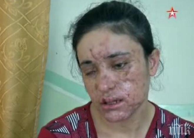 Избягала от ИДИЛ пленница в разтърсваща изповед: Пребиваха ме жестоко, насилваха ме, продаваха ме, правих бомби... (СНИМКА 18+)