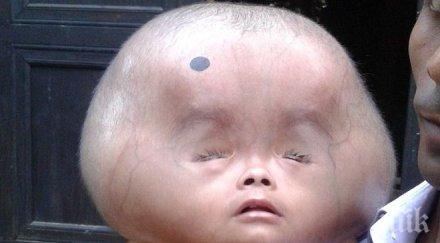 вярване главата годишно дете спира расте вече килограма снимки