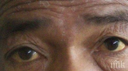 зараза плъхова болест налази варна