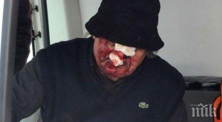 спор неплатен наем прати годишен мъж болница