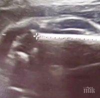 Пълен шаш! Американка е бременна с... автомобил (ШОКИРАЩА СНИМКА ОТ ВИДЕОЗОН)