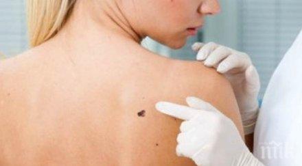 жегата слънцето хапе тумори кожата