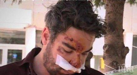 шокиращо френският фотограф пребит български шофьор ужасяващ разказ кървавото меле