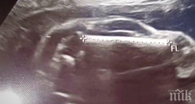 Пълен шаш! Американка е бременна с... автомобил (ШОКИРАЩА СНИМКА ОТ ВИДЕОЗОН)