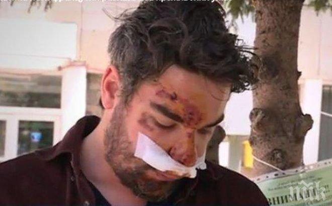 Шокиращо! Френският фотограф, пребит от български шофьор, с ужасяващ разказ за кървавото меле 