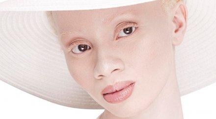 африканка албинос стана световна модна сензация снимки