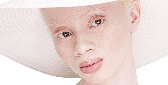 Африканка албинос стана световна модна сензация (снимки)