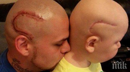 трогателно баща направи белег главата същия оперирания тумор син