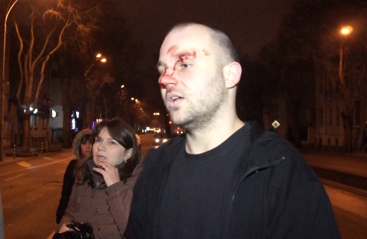 Разбиха носа на варненец заради плакат срещу ТИМ и кмета (видео)