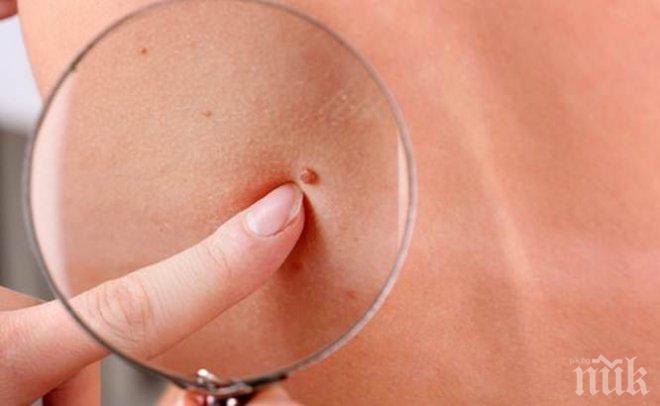 Лоша тенденция! Кожният рак расте много прогресивно 