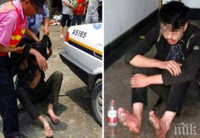 Не е за хора със слаби нерви! Краката на младеж се разлагат - шест дни постоянно играл онлайн игри