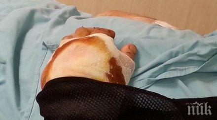 мъжът пришитата ръка проговори медиците направиха чудо видео