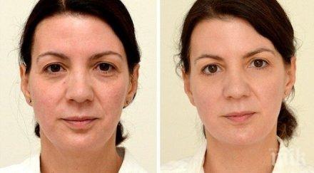 изумително отразяват литра вода ден