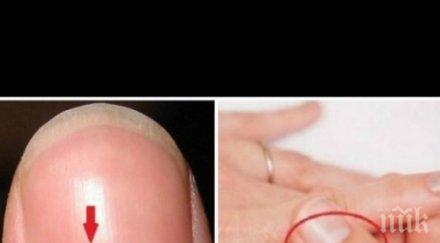 имате бял полумесец нокътя внимавайте