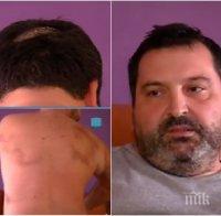 Напрежение в Плевенско! Заплашват мъжа, пребит от общински съветник на ДПС