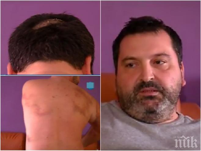 Напрежение в Плевенско! Заплашват мъжа, пребит от общински съветник на ДПС