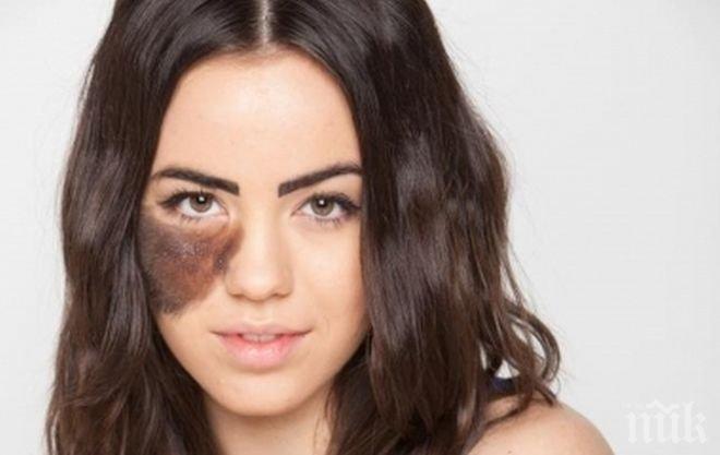 УНИКАЛНА МИСТЕРИЯ! Родилните белези разкриват предишния ни живот