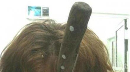 невероятна история брат заби нож главата сестра оцеля малък белег ужасяващи снимки