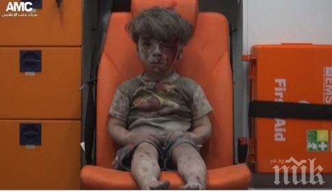 Почина братчето на сирийчето Омран, което трогна света