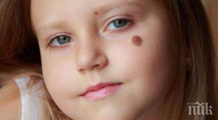 мистика родилните белези разкриват предишния живот