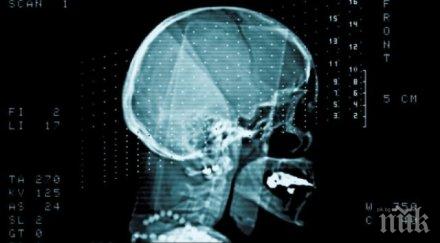 чудо смяната глава става реалност догодина