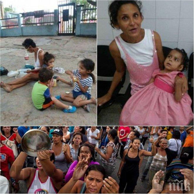 Ужас! Деца умират от глад в социалистическа Венецуела (ВИДЕО и СНИМКИ 18+)