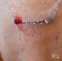 Кучета нахапаха зверски варненец в Морската градина